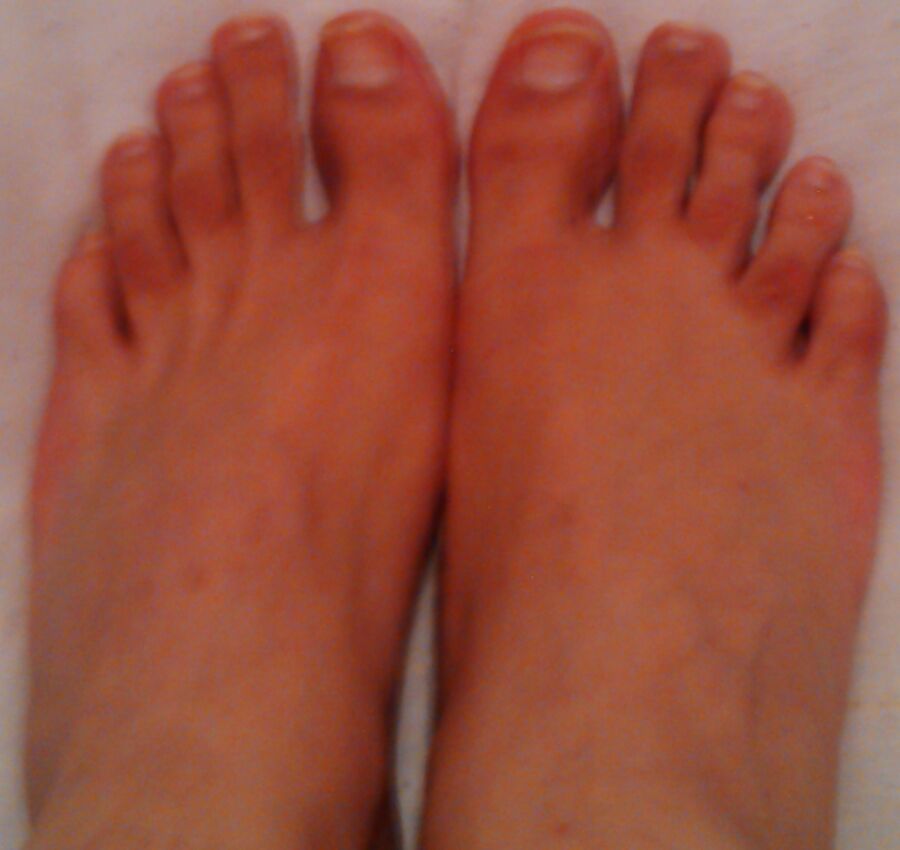 Free porn pics of My feet tops and toes 3 of 7 pics